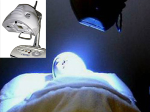 やまはな皮フ科クリニックのアイクリア(光療法)の画像